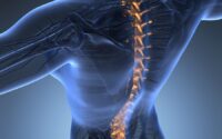 What Kind of Recovery Is Expected After a Spinal Cord Injury
